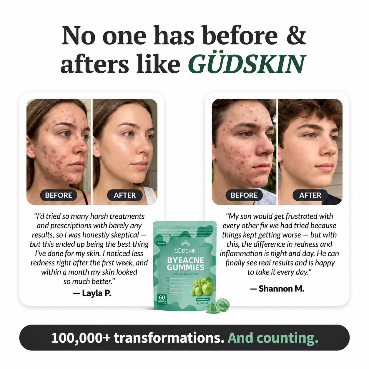 Acne Gummies